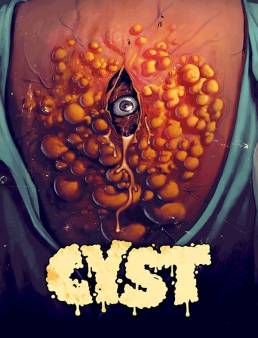 فيلم فيلم كيس Cyst 2020 مترجم اون لاين 2020